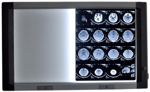 医用LED双联观片灯